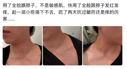 居家水光”：是院线平替，还是毁肤陷阱？